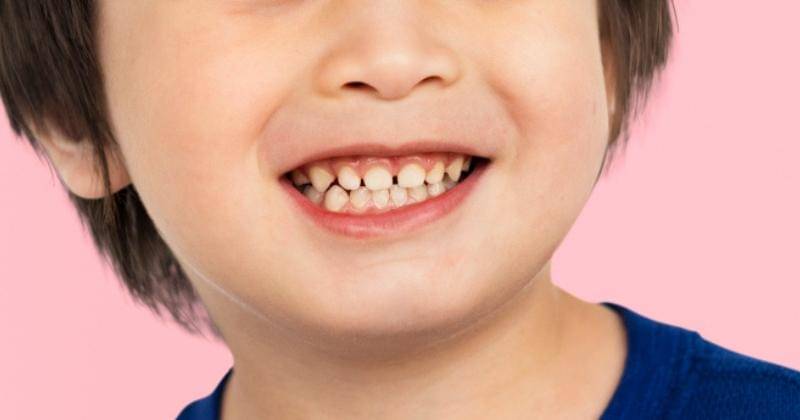 Ilustrasi - Freepik/rawpixel-com