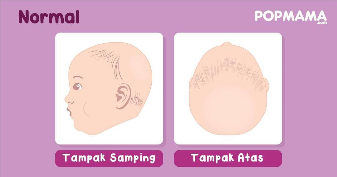 Popmama.com/Aristika Medina