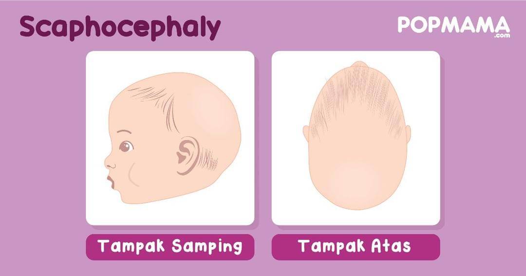 Popmama.com/Aristika Medina