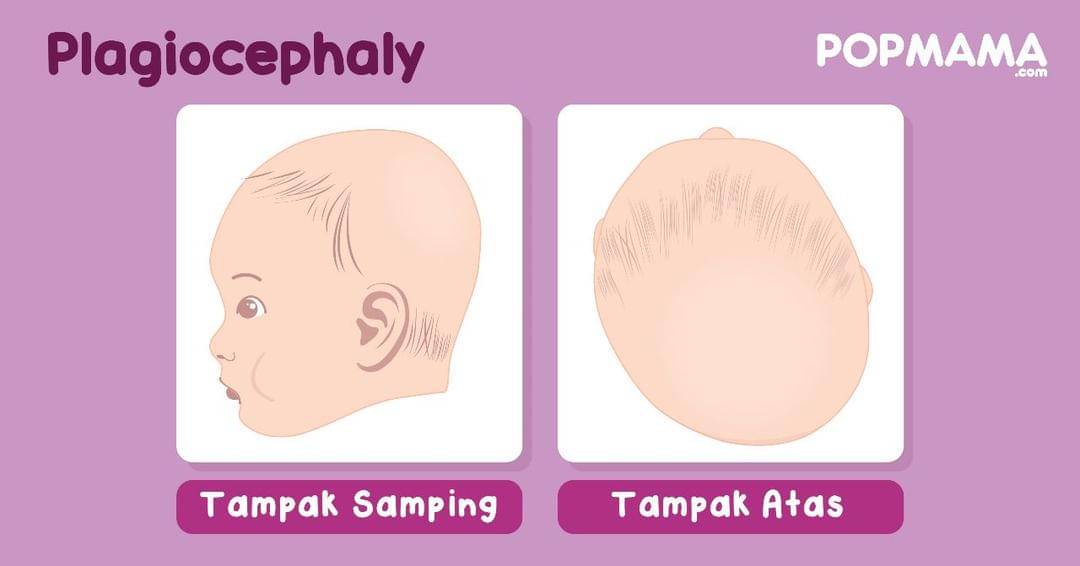 Popmama.com/Aristika Medina