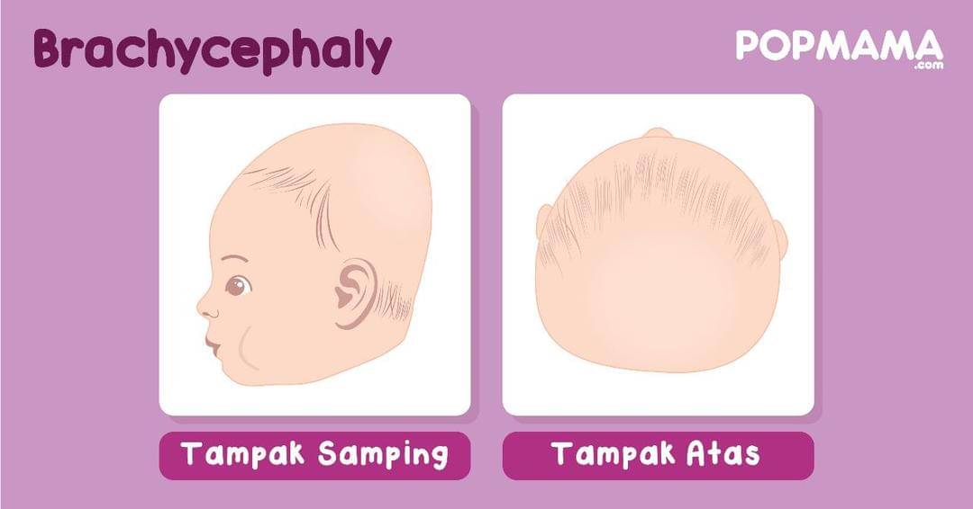 Popmama.com/Aristika Medina