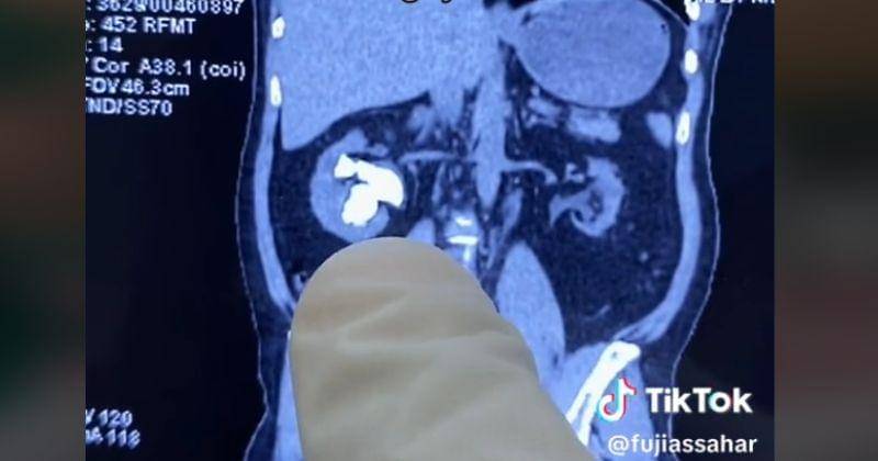 TikTok.com/Fujiassahar