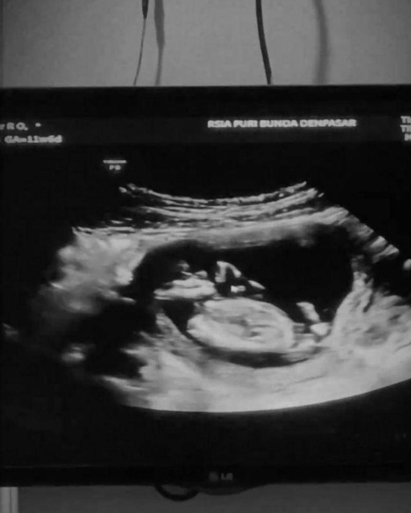 Instagram.com/jennifercoppenreal20