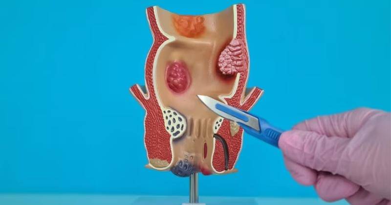 Freepik/nadezdagorosko