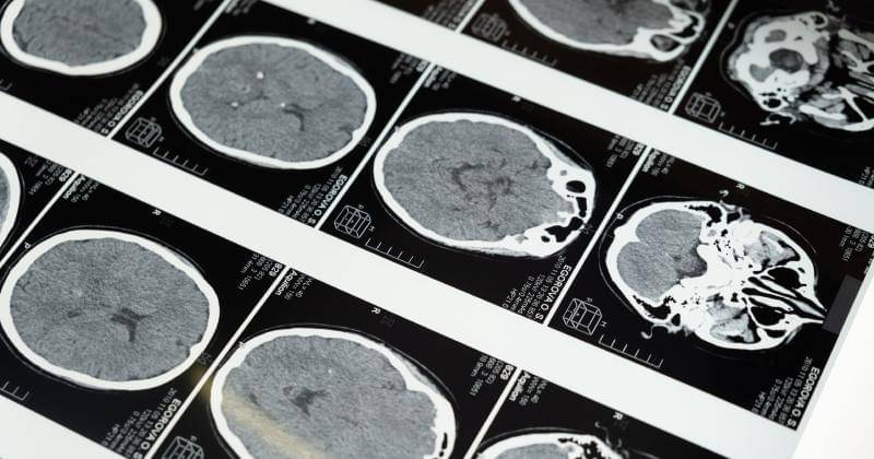 Pexels/Cottonbro Studios