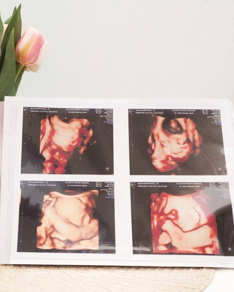 Instagram.com/musdalifahbasri