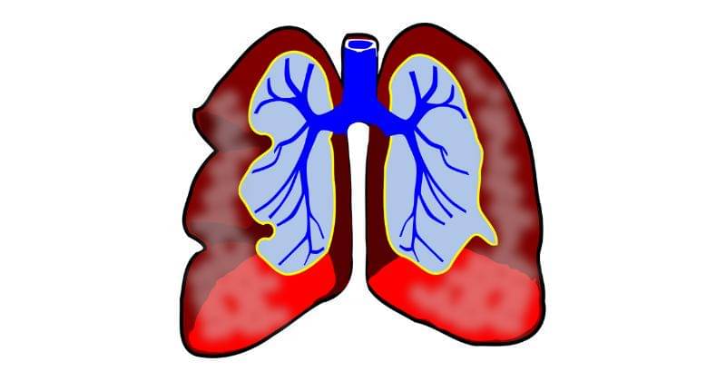 Pixabay/Clker-Free-Vector-Images