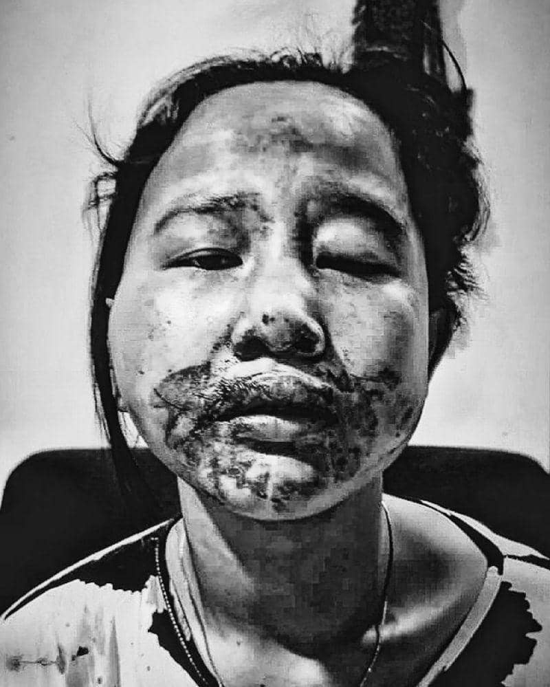 Instagram.com/viralciledug