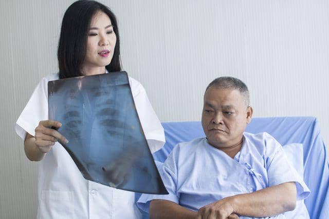 TBC Apakah Menular? Ini Fakta dan Pencegahannya