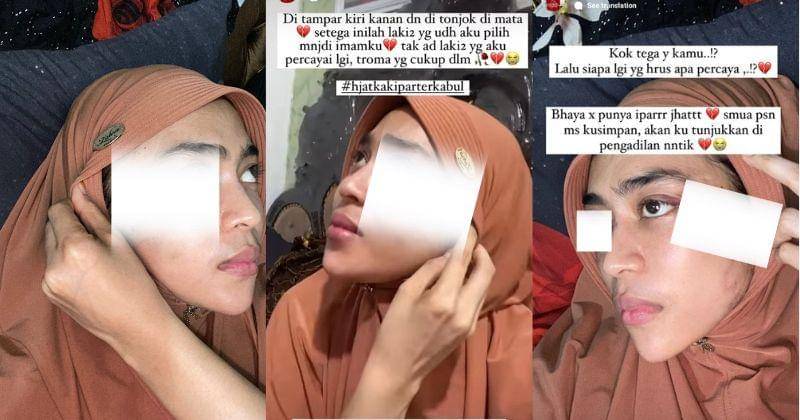 Gambar yang menunjukkan luka kekerasan sudah disensor - Instagram.com/tiara_luxury_boutiquee