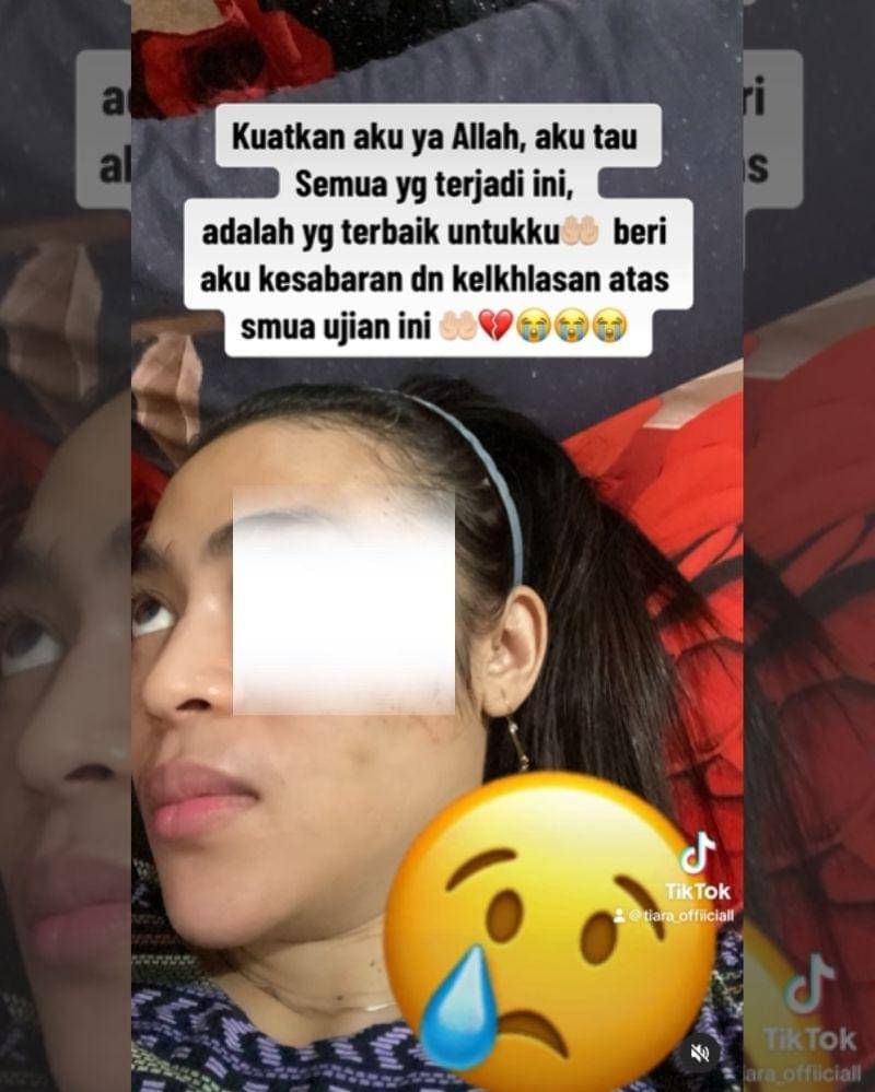 Gambar yang menunjukkan luka kekerasan sudah disensor - Instagram.com/tiara_luxury_boutiquee