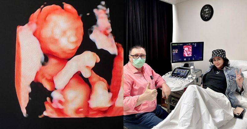 Instagram.com/denisechariesta91