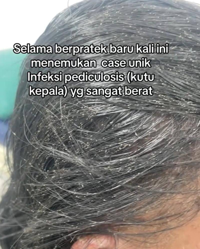 Tiktok.com/nuriusman