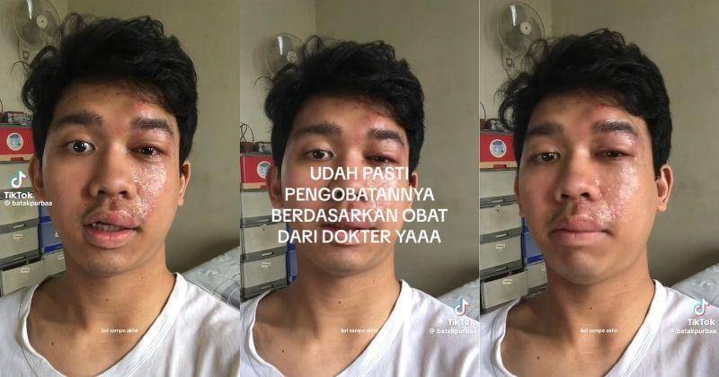 Tiktok.com/@batakpurbaa