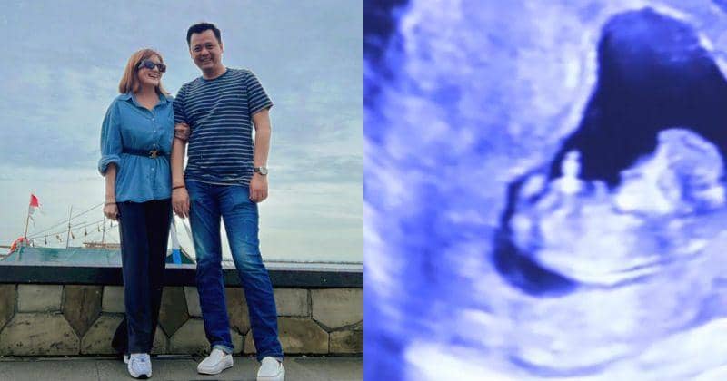 Selamat! Kiki Amalia Umumkan Hamil Anak Pertama di Usia 41 Tahun