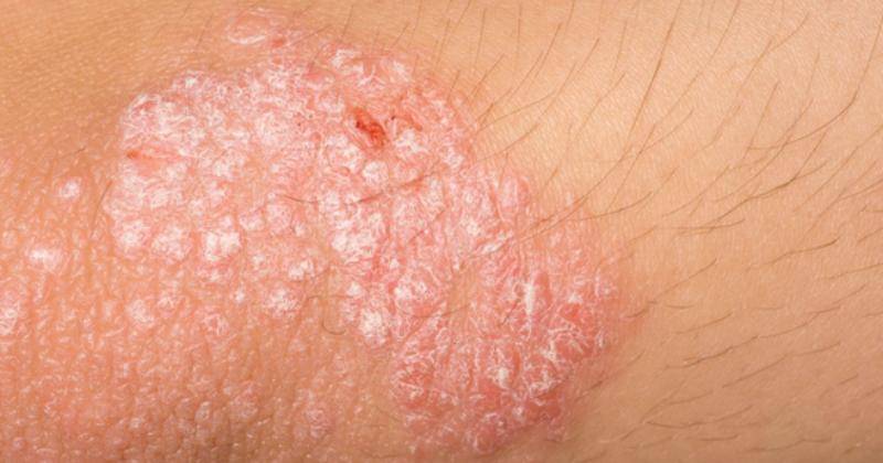 hodgedermatology.com