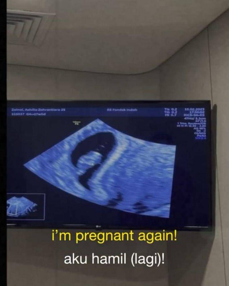 Instagram.com/@zhrtiaraashilla