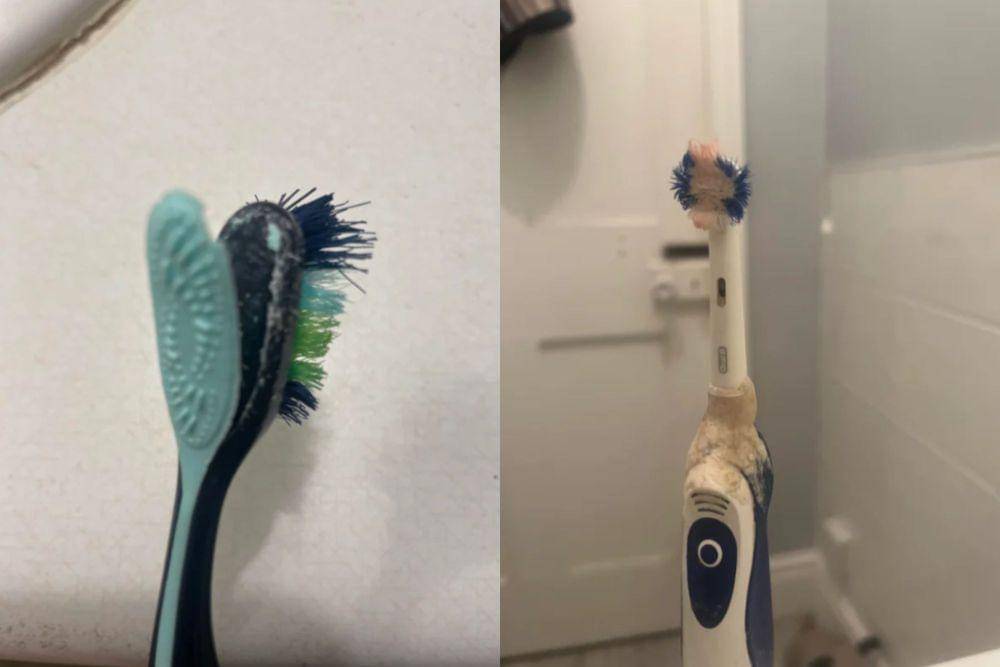 Cara Menyimpan Sikat Gigi yang Benar