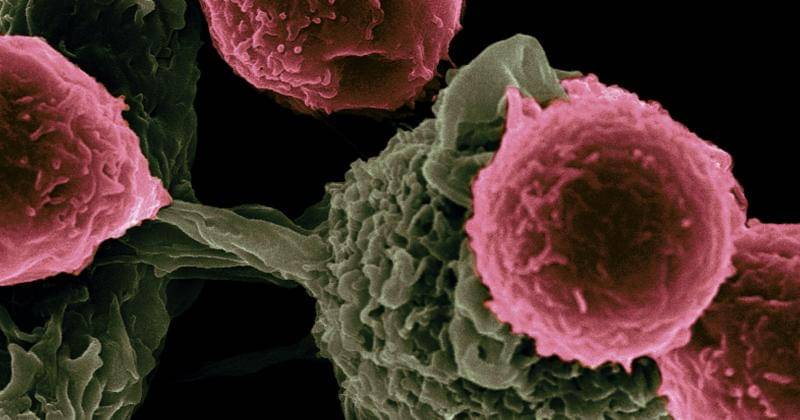 Unsplash/NationalCancerInstitute