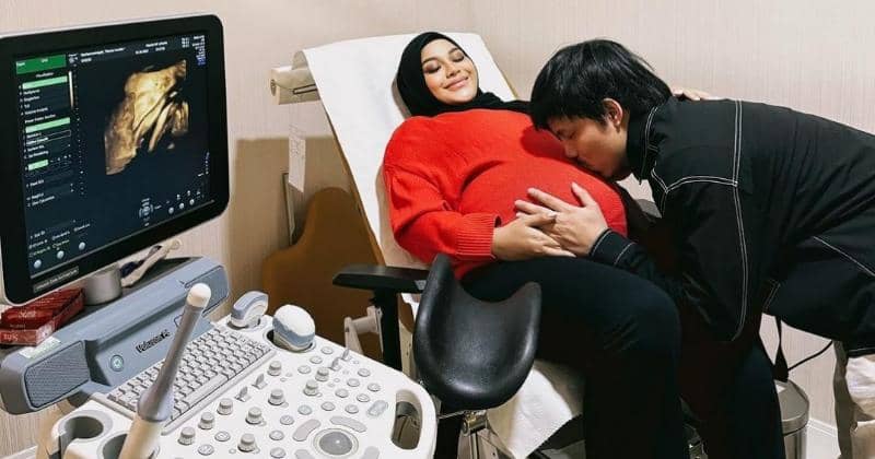 Instagram.com/aurelie.hermansyah