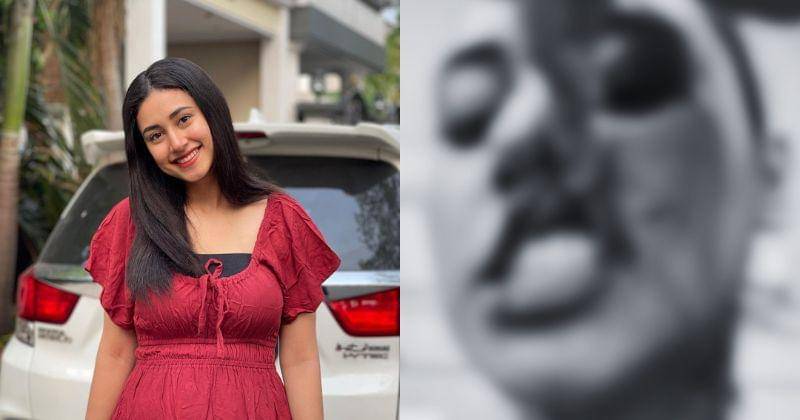 Seluruh gambar yang menampilkan luka kekerasan telah diblur - Instagram.com/afifahriyad