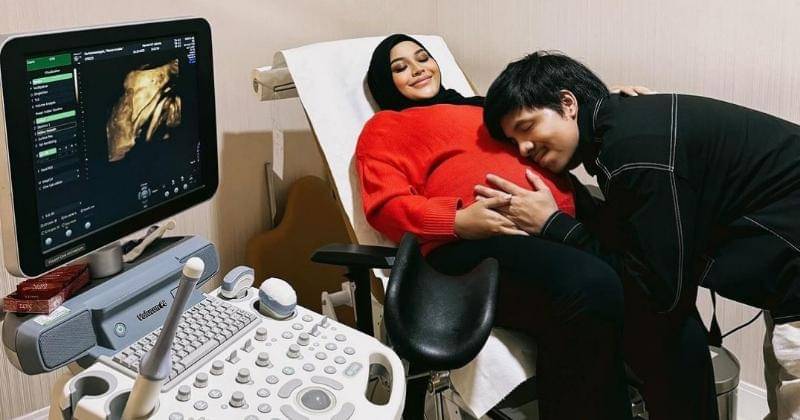 Instagram.com/aurelie.hermansyah