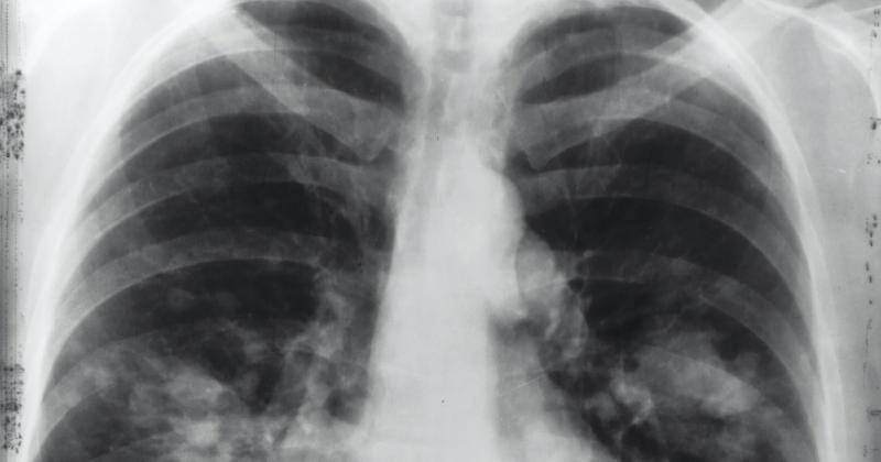 Unsplash/National Cancer Institute