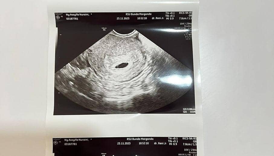 Instagram.com/@mom_ayting92_