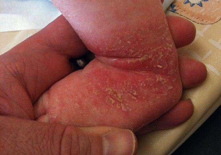 Commons.wikimedia.org/Gzzz