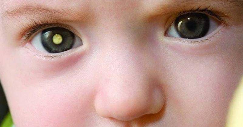 nationaleyecenter.id