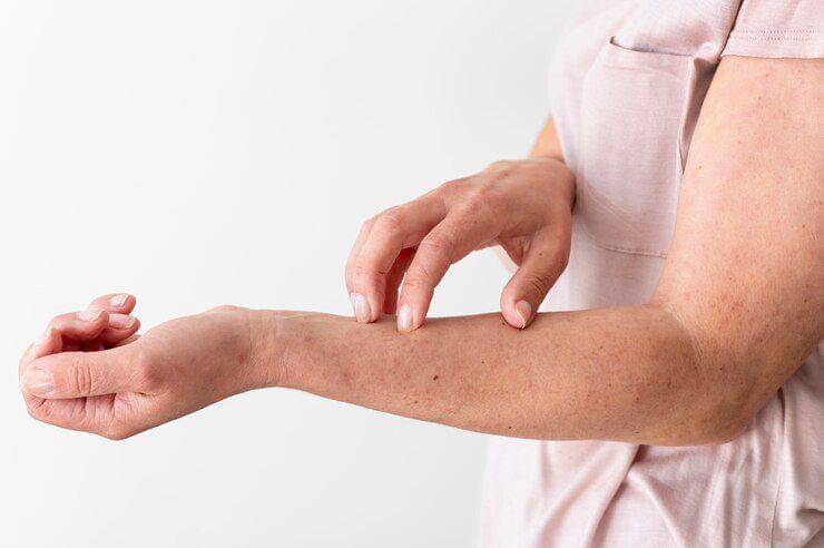 8 Penyebab Kelenjar Getah Bening, Jangan Diabaikan!