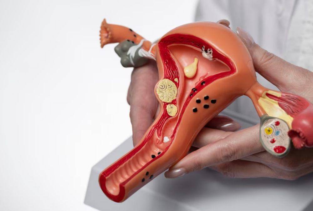 ilustrasi dokter memegang model anatomi rahim (freepik.com/freepik)