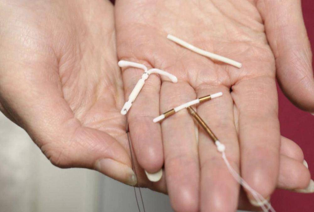 ilustrasi IUD hormonal dan IUD nonhormonal (asquithdoctors.com.au)