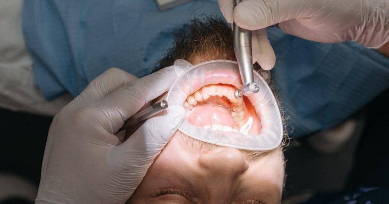 Kebiasaan Buruk yang Buat Gigi Rusak saat Puasa Ramadan