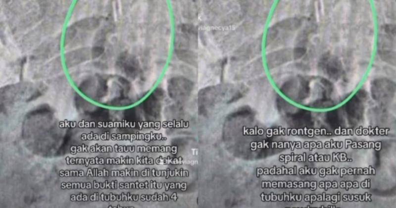 Instagram.com/steviagnecya