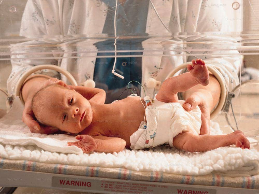 Apa yang dimasuk dengan bayi prematur?
