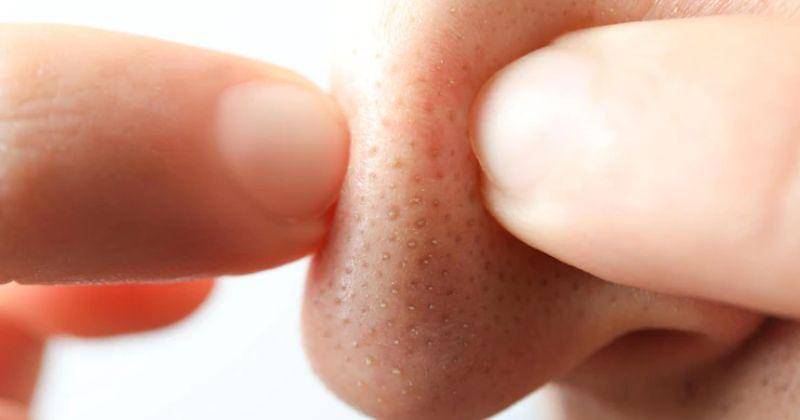 Freepik/Atlas Company