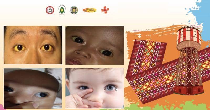 Popmama.com/Anggia Ramadhani Fitri