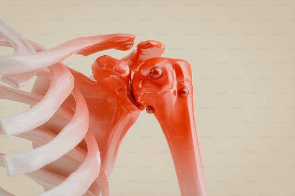 7 Penyebab Kanker Tulang, Kenali Bahaya Sejak Dini