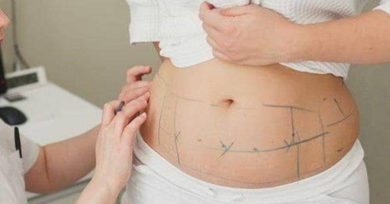 Dok. Atlanta Plastic Surgeon