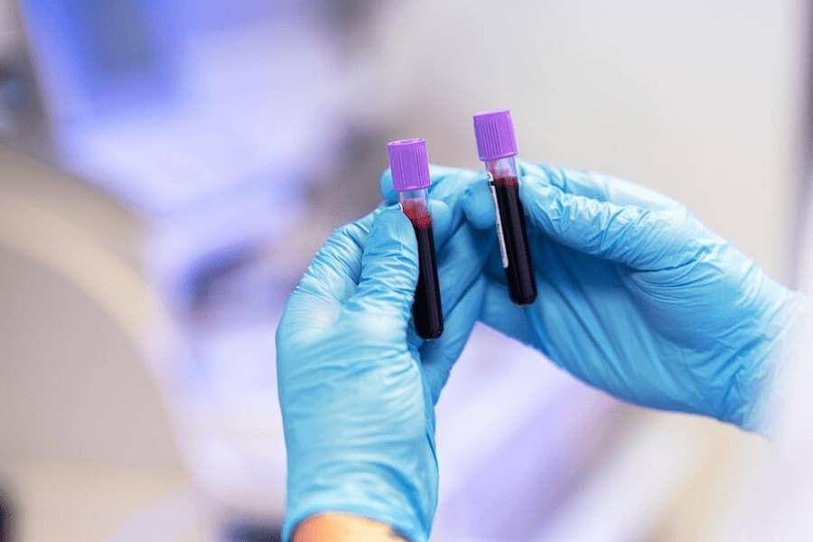 ilustrasi tes darah (freepik.com/freepik)