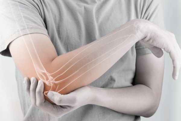 Apa Itu Kanker Tulang? Ini Jenis dan Faktor Risikonya