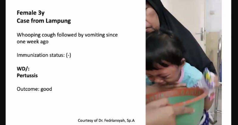 Zoom/Dr. Anggraini Alam, dr.,SpA(K)