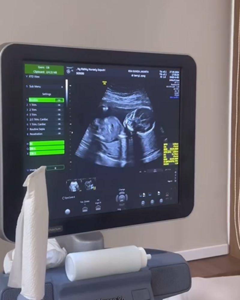 Instagram/kikysaputrii