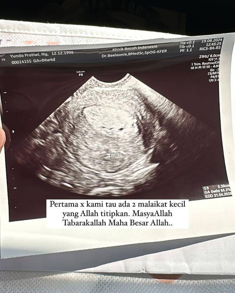 Instagram/yundafaisyah