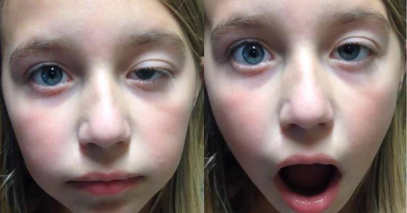 Facebook.com/Spokane Eye Clinic Pediatric Ophthalmology