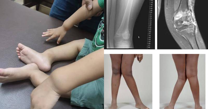 Instagram.com/dr_aditya_spak, Twitter.com/asaibrahim