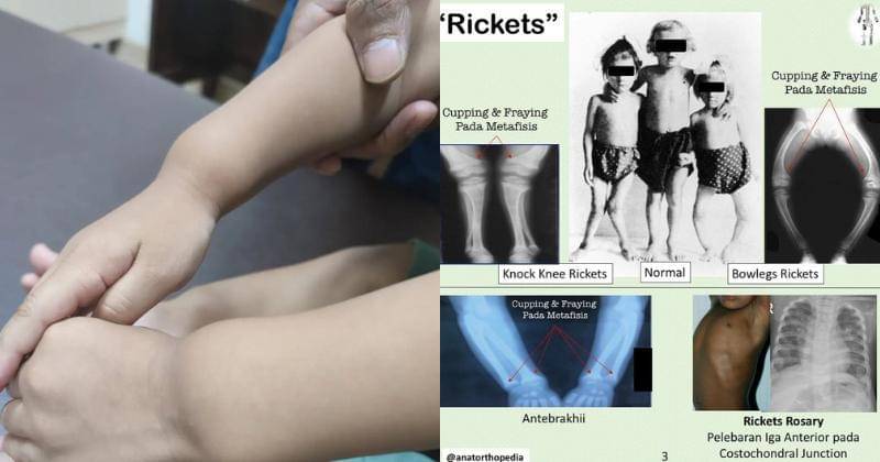 Instagram.com/dr_aditya_spak, Twitter.com/asaibrahim