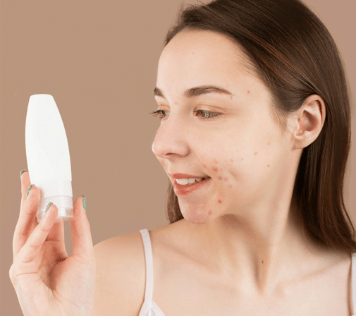 Ilustrasi wajah berjerawat (pexels.com/Anna Nekrashevich)