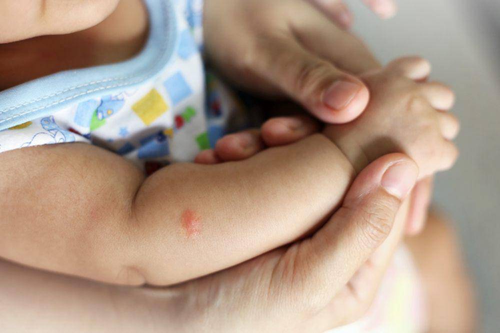 ilustrasi foto seorang bayi sedang terkena alergi. (freepik.com/nipol)